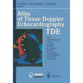 Atlas of Tissue Doppler Echocardiography — TDE