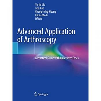 Advanced Application of Arthroscopy