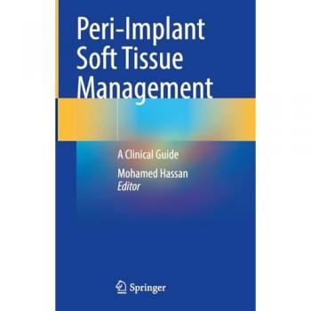 Peri-Implant Soft Tissue Management: A Clinical Guide