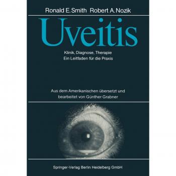 Uveitis