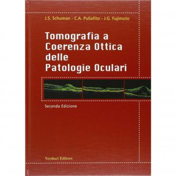 Tomografia e coerenza ottica delle patologie oculari