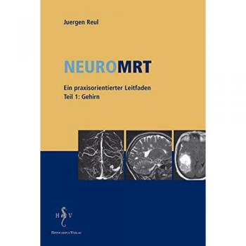 NeuroMRT 1