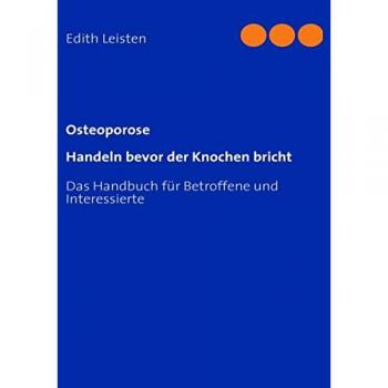 Osteoporose: Handeln bevor der Knochen bricht