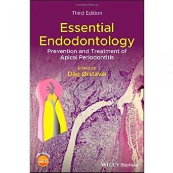 Essential Endodontology : Prevention and Treatment of Apical Periodontitis