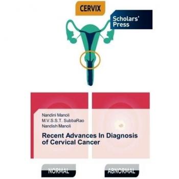 Recent Advances In Diagnosis of Cervical Cancer