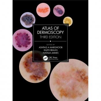 Vitalsource Technologies, Inc. Atlas Of Dermoscopy