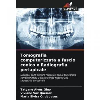 Alves Gino, Tatyane: Tomografia computerizzata a fascio conico x Radiografia periapicale