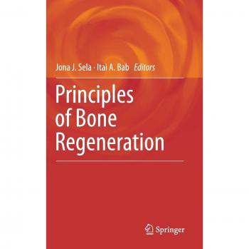 Principles of Bone Regeneration