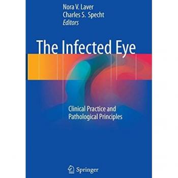 The Infected Eye