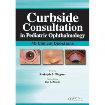 Curbside Consultation in Pediatric Ophthalmology: 49 Clinical Questions (Curbside Consultation in Pediatrics)
