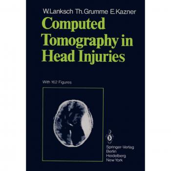 Computed Tomography in Head Injuries