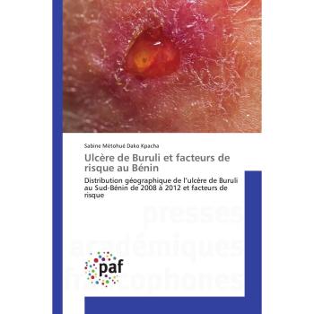 Ulcère de Buruli et facteurs de risque au Bénin: Distribution géographique de l’ulcère de Buruli au Sud-Bénin de 2008 à 2012 et facteurs de risque (Omn.Pres.Franc.)