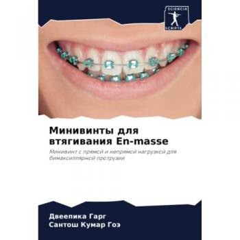 Минивинты для втягивания En-masse: Минивинт с прямой и непрямой нагрузкой для бимаксиллярной протрузии: Miniwint s prqmoj i neprqmoj nagruzkoj dlq bimaxillqrnoj protruzii
