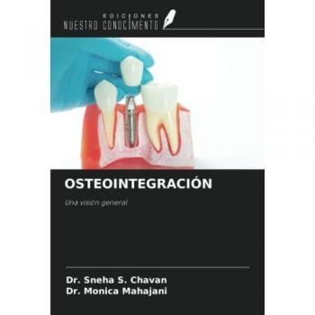 OSTEOINTEGRACIÓN: Una visión general