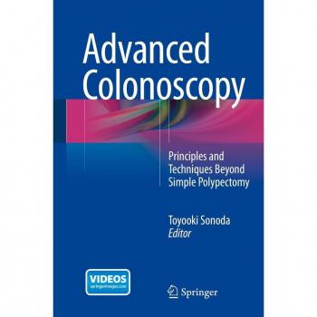 Advanced Colonoscopy