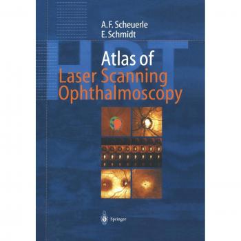 Atlas of Laser Scanning Ophthalmoscopy