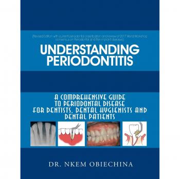 Understanding Periodontitis: A Comprehensive Guide to Periodontal Disease for Dentists, Dental Hygienists and Dental Patients