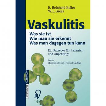 Vaskulitis