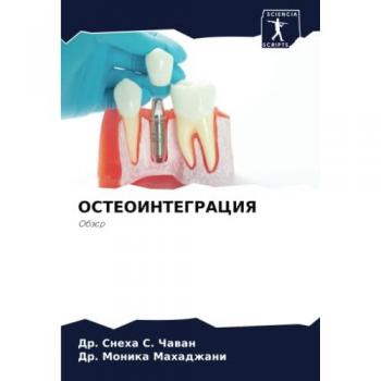 ОСТЕОИНТЕГРАЦИЯ: Обзор: Obzor