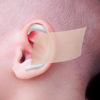 Parche Silicona Auricular para Bebés