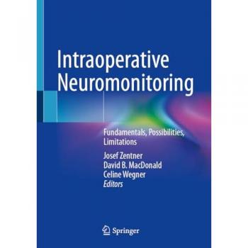 Intraoperative Neuromonitoring