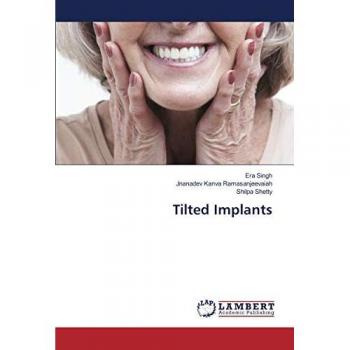 Tilted Implants