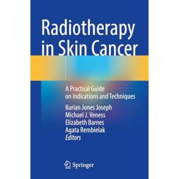 Radiotherapy in Skin Cancer: A Practical Guide on Indications and Techniques