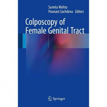 Colposcopy of Female Genital Tract