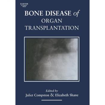 Vitalsource Technologies, Inc. Bone Disease Of Organ Transplantation