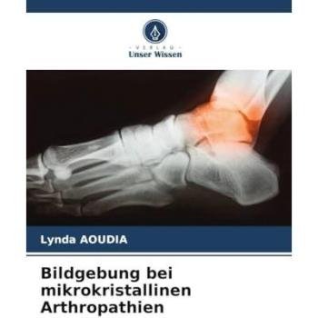 Aoudia, Lynda: Bildgebung bei mikrokristallinen Arthropathien