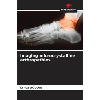 Imaging microcrystalline arthropathies