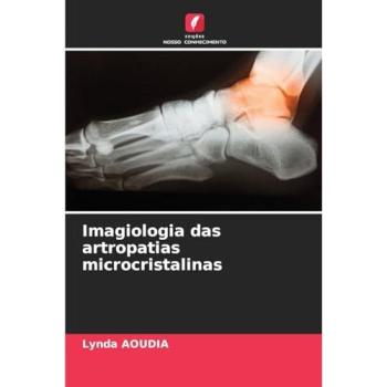 Aoudia, Lynda: Imagiologia das artropatias microcristalinas