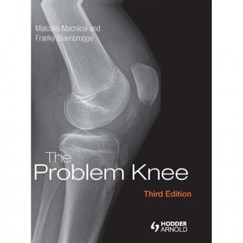 Vitalsource Technologies, Inc. Problem Knee
