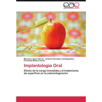 Implantología Oral: Efecto de la carga inmediata y el tratamiento de superficie en la osteointegración