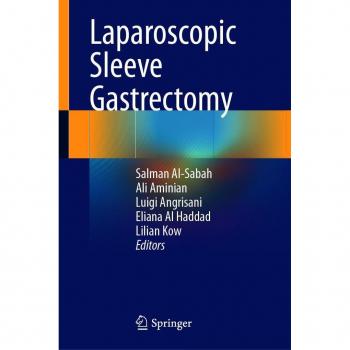 Laparoscopic Sleeve Gastrectomy