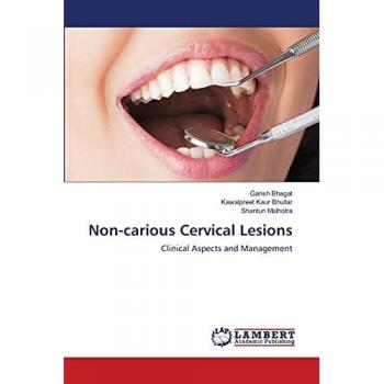 Non-carious Cervical Lesions: Clinical Aspects and Management